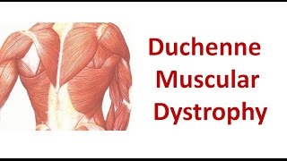 Duchenne Muscular Dystrophy [upl. by Aneekahs331]