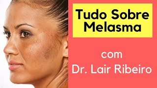 Melasma  Tratamentos para Melasma Dr Lair Ribeiro [upl. by Leihcim]