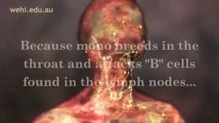 Symptoms of Mono  Mono Symptoms  Infectious Mononucleosis Disease [upl. by Holladay]