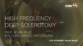 Surgery Video Application of High Frequency Deep Sclerotomy by Bojan Pajic [upl. by Cuyler552]