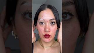 Sharing one of my fav videos as a reminder that no skin is bad 🤍 vitiligo acne poliosis skin [upl. by Nitsirc]