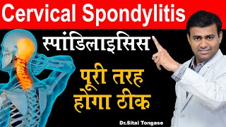 स्पॉन्डिलाइटिस पूरी तरह होंगा ठीक I Cervical Spondylosis  Cervical Exercise [upl. by Sparkie333]