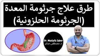 ١٨ طرق علاج جرثومة المعدة الجرثومة الحلزونية والأدوية المستخدمة في علاجها [upl. by Selig]