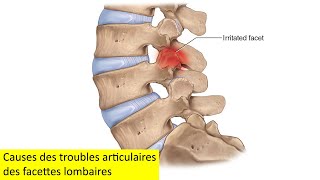 Causes des troubles articulaires des facettes lombaires [upl. by Rus193]