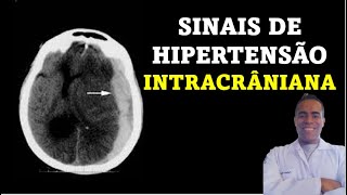 Sinais e Sintomas de Hipertensão Intracraniana Tríade de Cushing [upl. by Ahsieit]