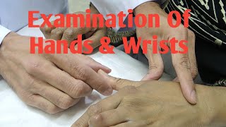 Rheumatological Hand Examination [upl. by Ymeraj218]