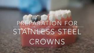 Stainless steel crown prep on a primary molar [upl. by Kenison]