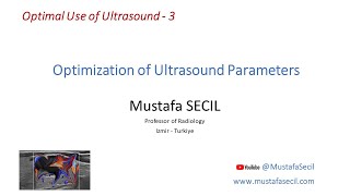 3 OPTIMAL USE OF ULTRASOUND  OPTIMIZATION OF PARAMETERS radiology ultrasound [upl. by Tedric]