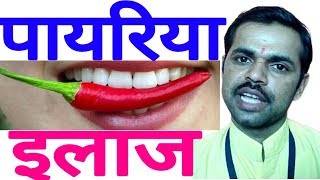 पायरिया का उपाय मुंह की बदबू का इलाज Payriya ilaj upay Treatment of Pyorrhea Dental Problems [upl. by Mar]