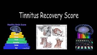 How to know if YOU can Recover from Tinnitus  Know your Tinnitus Recovery Score [upl. by Delsman]