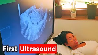 First ultrasound feel na feel na naman ni Butod Jerlyn  Dudkowski de Familia [upl. by Anagrom721]