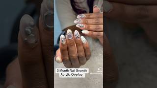 Acrylic Overlay Nail Growth over 5 Months nails nailart naildesign acrylicnails [upl. by Atinid]