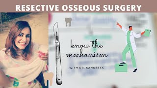 resective osseous surgery in periodontics [upl. by Nylrak]