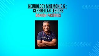 Neurology Mnemonic 6  Cerebellar lesions [upl. by Lundt]