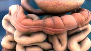 Colonoscopy Video Tour Removal of a Colon Polyp Polypectomy [upl. by Lebanna]