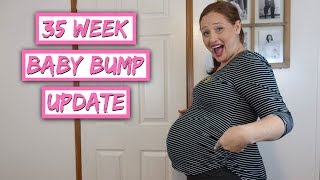 Why I Want A Natural Birth  35 WEEKS PREGNANT UPDATE [upl. by Nnhoj774]