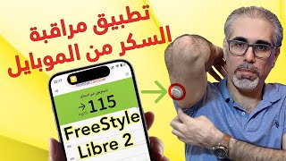 تجربتي في تثبيت مستشعر FreeStyle Libre 2 للمراقبة الفورية لمستويات السكرتحكم في مرض السكري [upl. by Falcone]