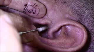 ASMR ear cleaning แคะหูเด็กดำรงค์ 5 [upl. by Neih]