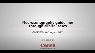 ISUOG 2021 Miguel Branco – Neurosonography guidelines through clinical cases [upl. by Ahcurb]