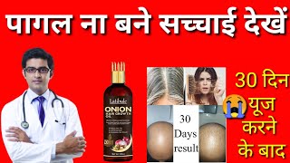 Latibule black seed onion hair oil uses benefits latibule black seed onion hair oil [upl. by Beale]