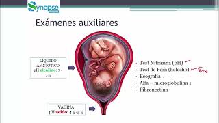 EMERGENCIAS OBSTETRICAS 4  PRE SERUMS [upl. by Sarid417]