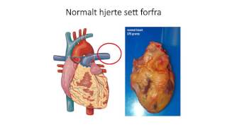 Sirkulasjonssystemet Hjertets anatomi [upl. by Harraf]