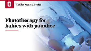 Phototherapy for babies with jaundice  Ohio State Medical Center [upl. by Ylus845]