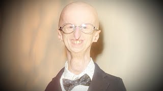 Sammy Basso Oldest Living Person With Progeria Dies at 28 [upl. by Fowler]