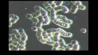 ALKALINITY vs ACIDITY [upl. by Ignatius]