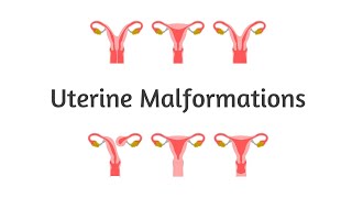 Uterine Malformations  Embryology  Gynecology  High Yield  USMLE  NEET PG  INICET [upl. by Ryan]