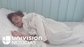 Cada vez más niños mueren por desnutrición extrema en México [upl. by Yroc]