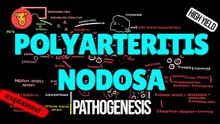 POLYARTERITIS NODOSA Pathogenesis Mechanism of Clinical symptoms Treatment [upl. by Bobbie]