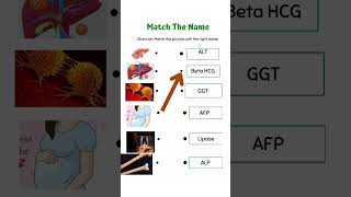 Match the following type question in Biochemistry  Enzyme  protein as diagnostic marker ytshorts [upl. by Ethbinium]