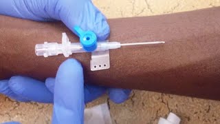 INTRAVENOUS CANNULATION TECHNIQUE  NURSING SKILLS PRACTICE [upl. by Kacerek]