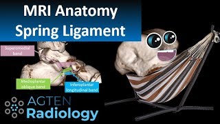 Spring Ligament Complex MRI Anatomy [upl. by Mariquilla387]