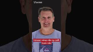 Nâng cấp nụ cười hoàn hảo với Veneer  Platinum Dental Group shorts veneers [upl. by Akerdnuhs]