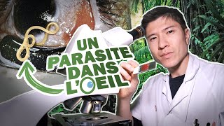 Un PARASITE dans votre OEIL [upl. by Brout442]