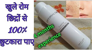 optimals even out toner by oriflamereviewexperience of 4 months Indian beauty talkies [upl. by Oijile80]