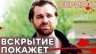 🔪 Сериал ВСКРЫТИЕ ПОКАЖЕТ  1 сезон  6 СЕРИЯ [upl. by Herwin249]