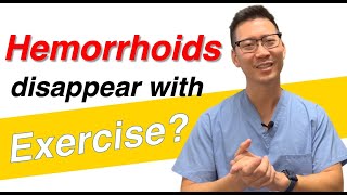 Can I keep hemorrhoids away with exercise [upl. by Morentz]