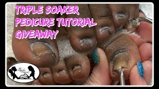 Pedicure Tutorial Excessive Buildup Removal Toenail Cleaning 😎 [upl. by Elhsa907]