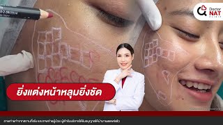 ยิ่งแต่งหน้าหลุมยิ่งชัด [upl. by Udela]