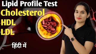 Lipid Profile test  How to read report  What is cholesterol What is triglyceride Diet advise [upl. by Neirol]