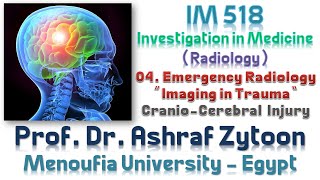 04 Undergraduate Medical Imaging and Radiology Fundamentals  CranioCerebral Injury [upl. by Eerej]