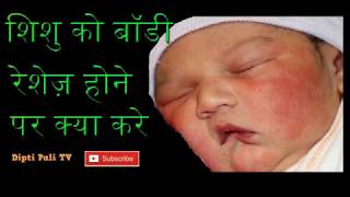 Shishu ko body rashes hone par kya kareBaby EczemaBaby ke rashes kese dur karebaby acne in hindi [upl. by Childs]