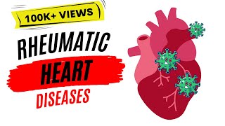 Rheumatic heart disease  Rheumatic fever [upl. by Bremble]