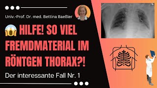 😱 Hilfe So viel Fremdmaterial im Röntgen Thorax Ein erster Beispielfall mit Befundung [upl. by Mcmath599]