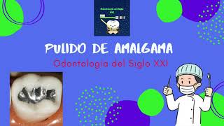 Pulido de amalgama dental [upl. by Derreg108]