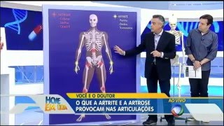 Artrite e artrose saiba como prevenir e tratar no Você e o Doutor [upl. by Hras]