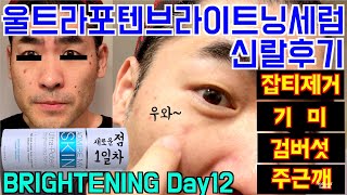 어드마이어마이스킨 DAY12 피부가 진해졌다구요 걱정마세요  울트라포텐브라이트닝세럼  Admire my skin ultra potent brightening serum [upl. by Nipahc]